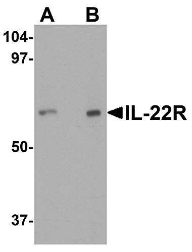 Anticorpo do receptor IL-22