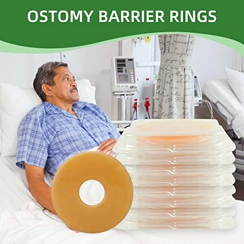 Anéis de barreira de ostomia, anel de barreira moldável, anel de barreira de selo de ostomia para sacos de ostomia