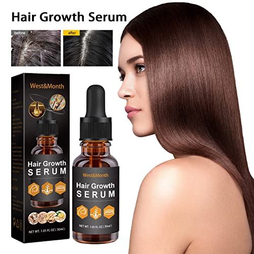 Crescimento do cabelo Óleo essencial, óleo de alecrim puro para crescimento de cabelos e couro cabeludo