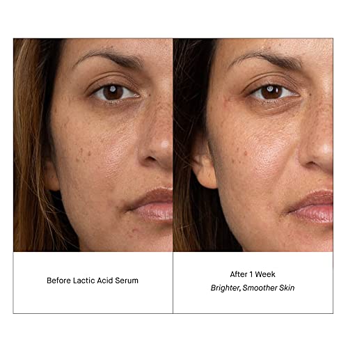 Shani Darden Skincare ácido lático Face Face Travel Tamanho, soro PM ativo para iluminar e liso, 0,34