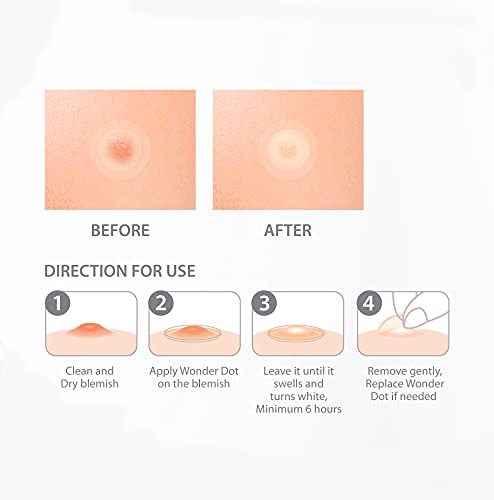 Maravilha do ponto de acne de acne - 1 pacote 39 patches espinhas de espinha cura Hidrocolóide Facial Clear Dots