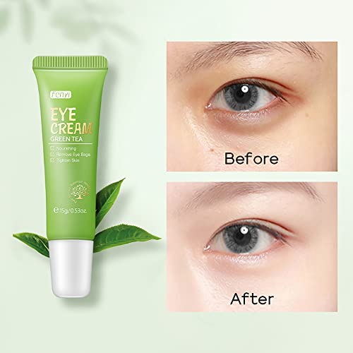 Creme de cuidados com os olhos verdes akary elimine o saco de olho círculos escuros extrato de folha de chá creme para os olhos para nutrir áreas oculares e apertar a pele